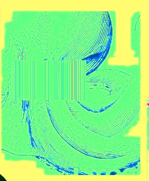 Octopus fragment #2 yellow background lime green swirly close up of fragment of octopus tentacles with blue edging and a green ISBN symbol - the piece looks like dollar signs or dollar bills under a microscope. 